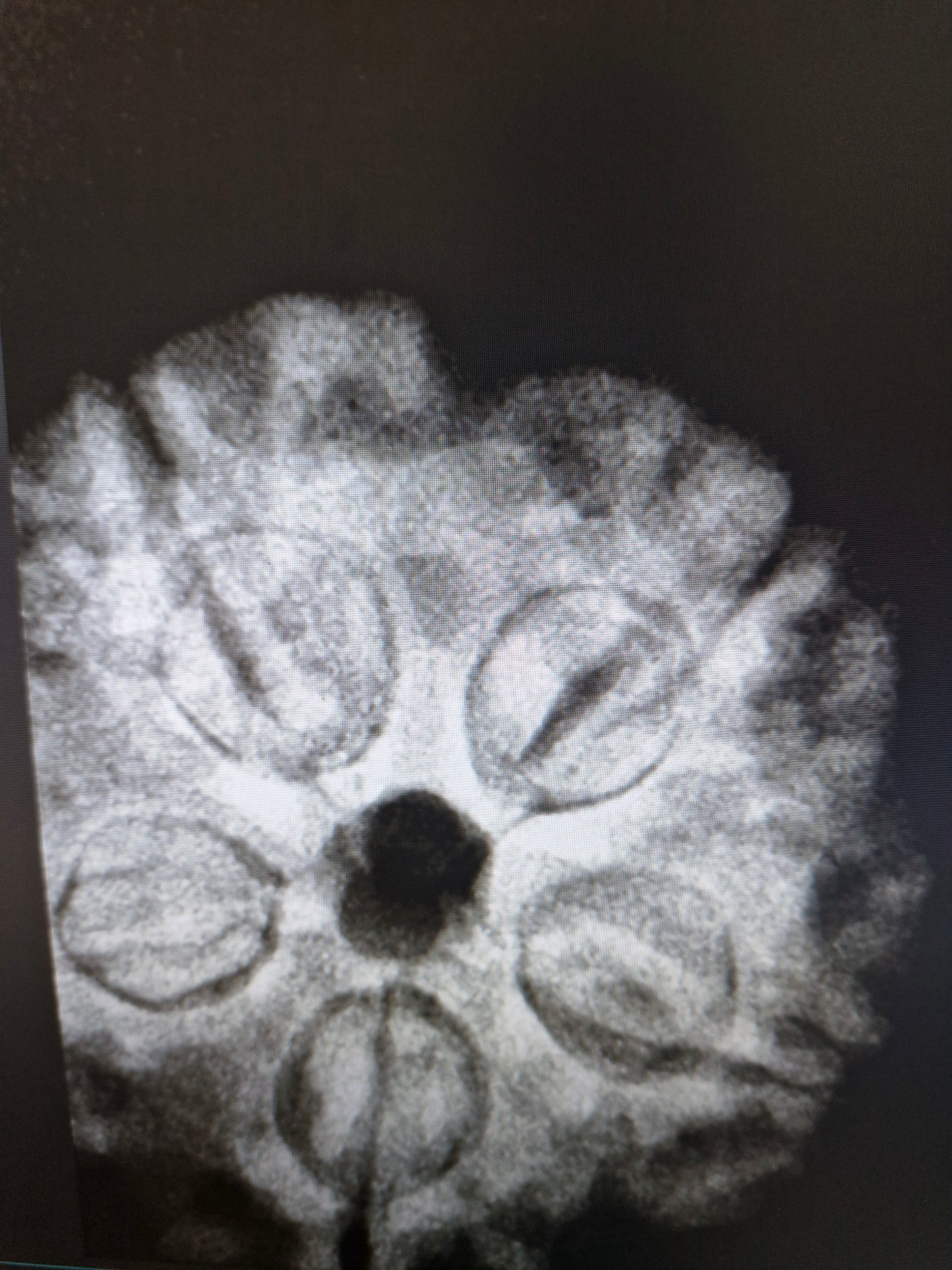 Original 5 Mukhi Rudraksha from Nepal 20mm+ | X-Ray Certified Panchmukhi Bead